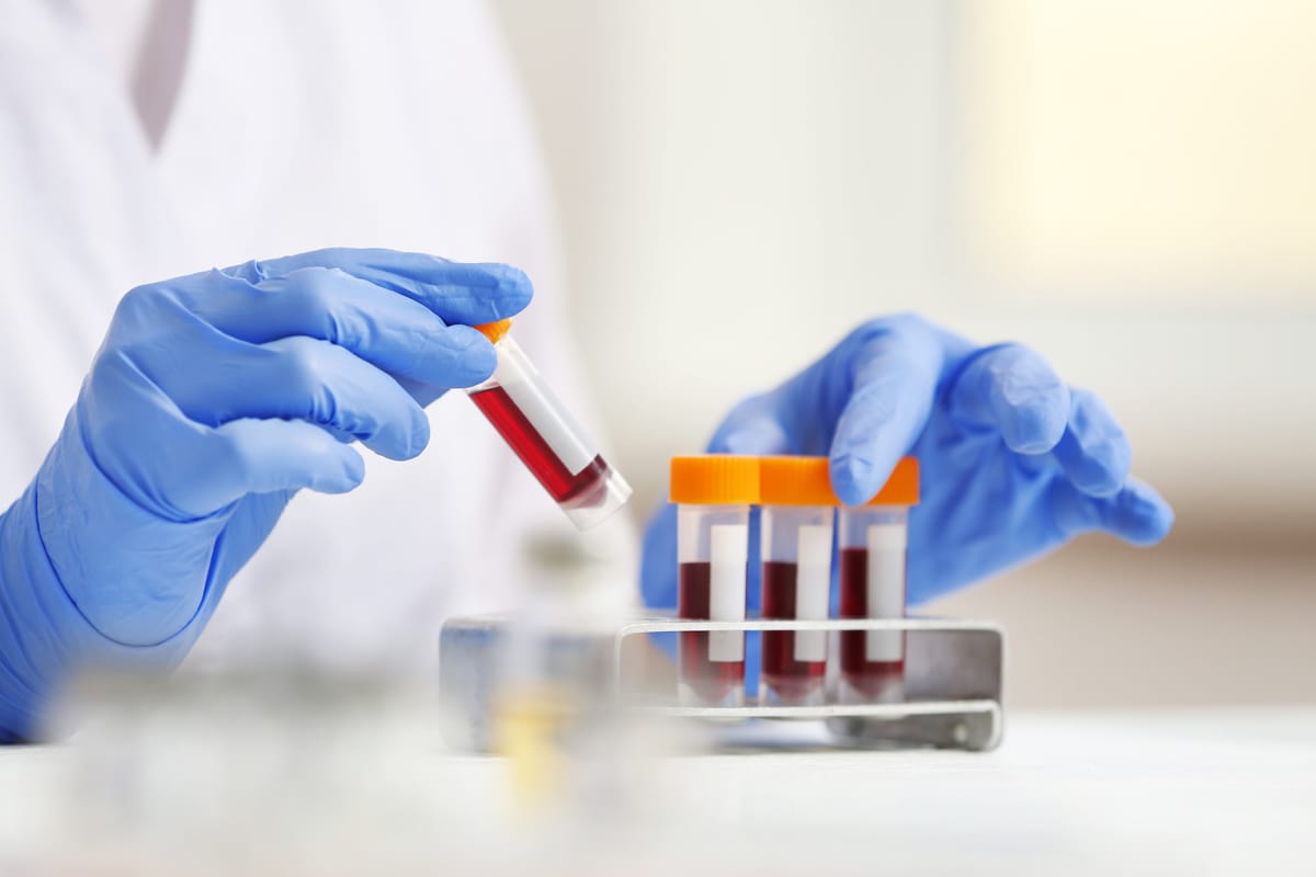 A New Era in Alzheimer’s Diagnosis